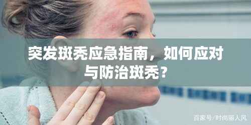 突发斑秃应急指南,如何应对与防治斑秃?